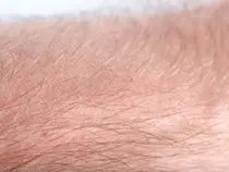 피부 빛 이용한 검사로 사망 위험 예측 