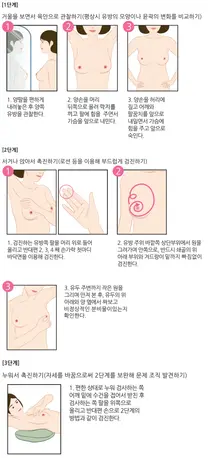 고대안암병원 여성암 사망 1위 '유방암'…조기발견 중요