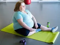 비만, 젊은 여성 결장암 위험 2배 높여