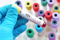 GSK사 HIV 병용요법, 후기 임상 성공