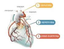 한림대동탄성심병원, 초고령환자 동시 3대 심장수술과 대장암수술 성공