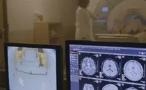 한국의학연구소, 작년 암 1629건 조기 발견