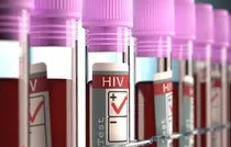 HIV 보유인, 고혈압 위험 높아