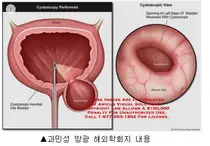 동아ST, 과민성방광 치료제 신약 속도전