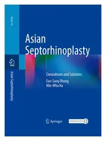 고대구로 동은상 교수, 獨스프링거와 Asian Septorhinoplasty 저서 출간