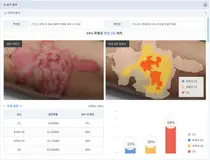 파인헬스케어, AI기반 '욕창 단계 예측 솔루션 시스템' 개발