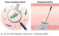 아주대병원, 헬리코박터균 새 진단법 미국소화기내시경학회지(GIE) 게재