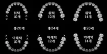 강동경희대병원, 건강한 노년 위한 최소 치아 갯수는