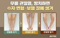 기온 떨어지면 수술 급증하는 무릎 관절염, 그 이유는?