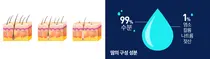 더운 여름철 '모발이식' 생착률 떨어트린다?