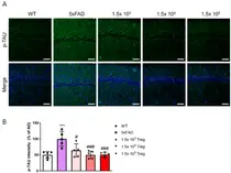 브이티바이오, VT301 알츠하이머 치료제 치료 효과 입증