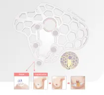 애니메디솔루션, '환자 맞춤형 수술 가이던스' 혁신의료기술 선정