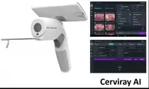 아이도트, 필리핀 CerviQ와 2000만 달러 규모 수출 계약 체결