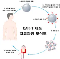 소아백혈병 CAR-T 치료제, 국내 최초 생산 