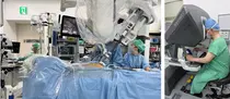 단일공 로봇 생체 신장이식 아시아 최초 성공
