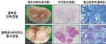 바이러스 감염으로 인한 결핵 악화 기전 규명