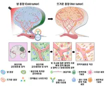가톨릭대-㈜엔비알, 교모세포종 치료 효과 높인 광면역나노플랫폼 개발