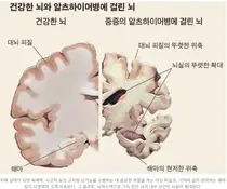 '효능검증'에 '콜린' 제약사 무더기 제품 포기?