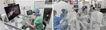 서울대병원, 휴고 로봇으로 고난이도 난소암 수술 국내 최초 시행