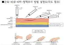 'SC제형' 허가 본격화…면역항암제 시장 확대