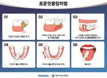 국내 여성 암 1위 유방암, 잇몸병 환자서 발병 위험 더 높아