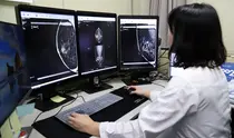 경상국립대병원, AI 활용한 유방암 조기 진단 소프트웨어 도입