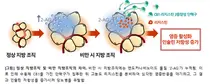 염증인자 리지스틴, 인간 당뇨병 발생 규명
