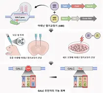 희귀질환 크라베병, 유전자 편집으로 치료
