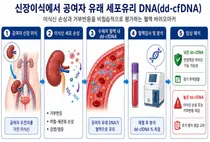 신장이식 후 불필요한 조직검사 줄인다, 거부반응 정밀 선별 입증