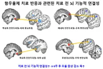 청소년 우울증 항우울제 치료 반응, 치료 전 ‘뇌 기능적 연결성’ 예측