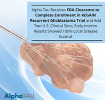 알파타우, 미국 FDA 추가 승인받아 악성 뇌종양 美 임상 확대