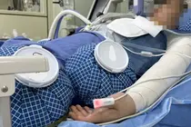 한림화상재단·더멀매트릭스, 화상환자 위한 동행 8년째