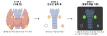 분당서울대병원 외과 최준영·이자경 교수 연구팀