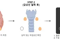 분당서울대병원 외과 최준영·이자경 교수 연구팀