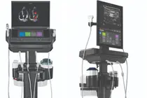 JW메디칼, 프리미엄 현장진단 초음파기기 ‘소노사이트 PX·ST’ 2종 출시