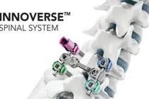 시지메드텍 ‘INNOVERSE Spinal System’, 콜롬비아 INVIMA 허가