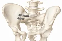 메디쎄이, FDA 510(k) 인증 3건 획득...美 척추 임플란트 시장 강화