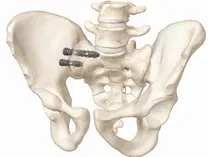 메디쎄이, FDA 510(k) 인증 3건 획득...美 척추 임플란트 시장 강화