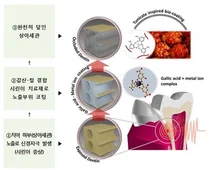 국내 연구진, 시린이 치료 소재 개발 성공