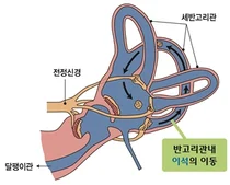 강동경희대병원, 이석증 여성이 남성보다 2배 많은 이유는?