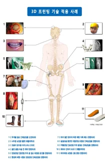 국제성모병원, 머리부터 발끝까지 3D프린팅 기술로 새시대 연다