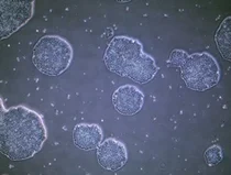 줄기세포로 파킨슨병 치료… 일본서 첫 임상