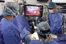국내 최초, 3D 내시경 이용 심장수술 성공