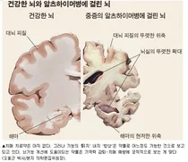 대웅바이오그룹도 '콜린' 환수협상 취소소송 패소