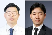 원형탈모증 원인 면역세포 찾았다