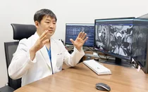 휴먼영상의학센터 정혜두원장팀, 전립선동맥색전술 600례 달성