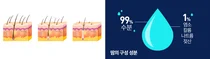 더운 여름철 '모발이식' 생착률 떨어트린다?