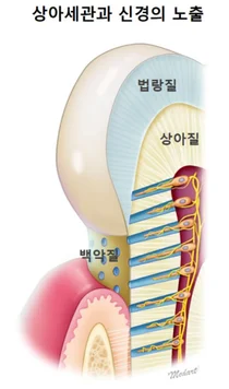 서울대치과병원, 유전자를 이용한 시린이 치료제 상용화 눈앞