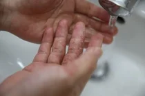 고대안암, 주부습진 이제는 남녀노소 주의해야할 때