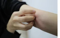 고대구로, '환절기' 피부 건강에 적신호